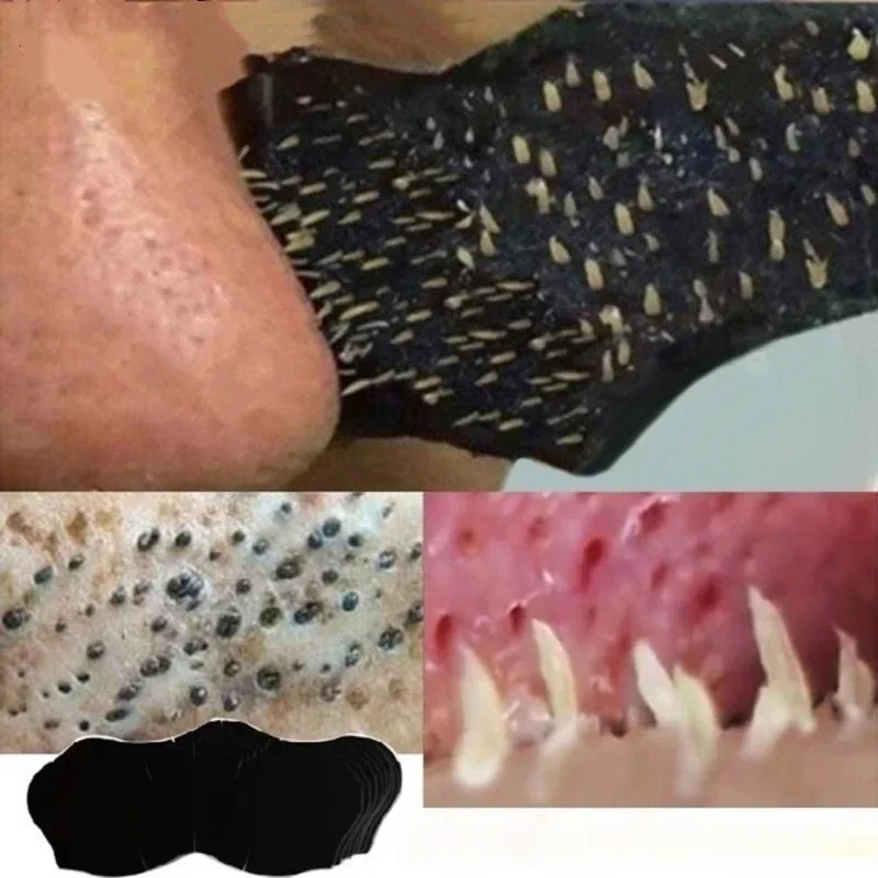 Charcoal Pore Strip - 10 PC/50 PC 100 PC mee-eter