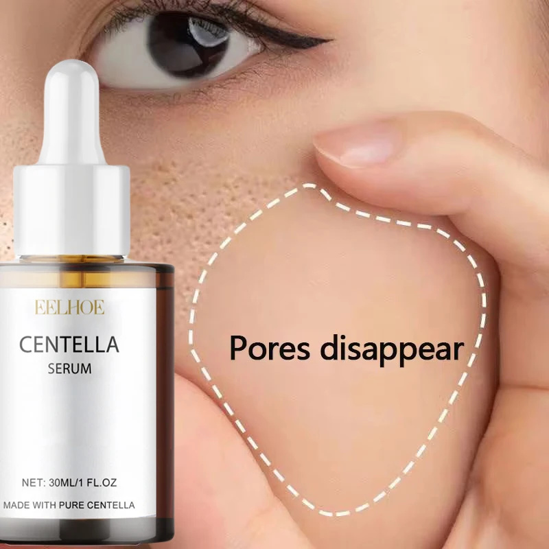 Centella Asiatica Toner - Centella Asiatica Gezicht Serum Voeden Droge