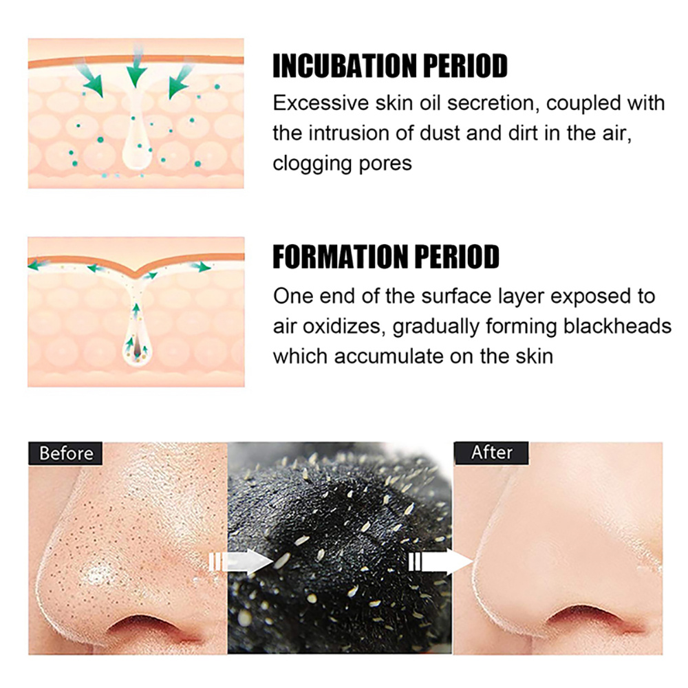 10/20/50/100 Stuks Diepe Reini - Charcoal Pore Strip recensie en prijs