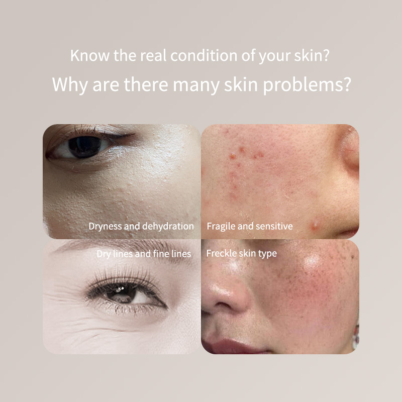 Draagbare huidtesterpen - alle - Skincare Only You recensie en prijs