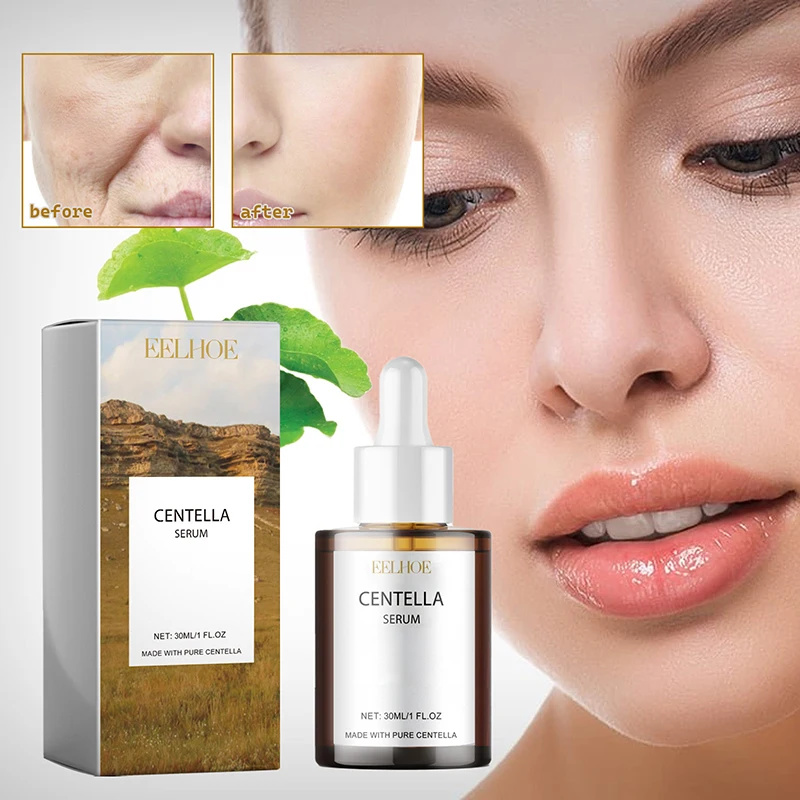 Centella Asiatica Gezicht Seru - Centella Asiatica Toner recensie en prijs