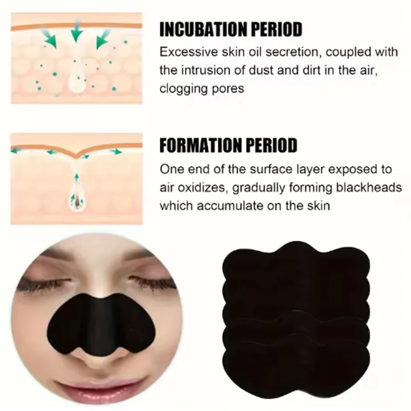 10/20/50 stuks houtskool mee-e - Charcoal Pore Strip recensie en prijs